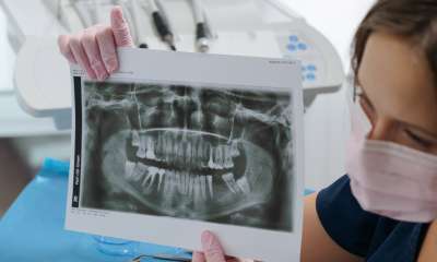 VRSTE ZUBA: Koji tipovi zuba postoje?