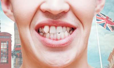 Imaju li Britanci zaista loše zube?