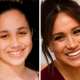 15 poznatih osoba koje su promijenile zube za savršen osmijeh
